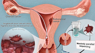 Pap test in gravidanza si può fare?